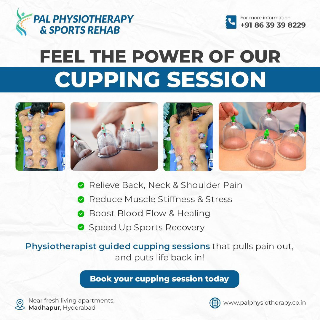 PAL Physiotherapy - Cupping Therapy